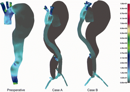 Figure 7. Shear stress distribution for the cases before and after treatment.