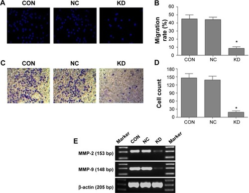 Figure 4 B7-H3 knockdown inhibits tumor migration and invasion.