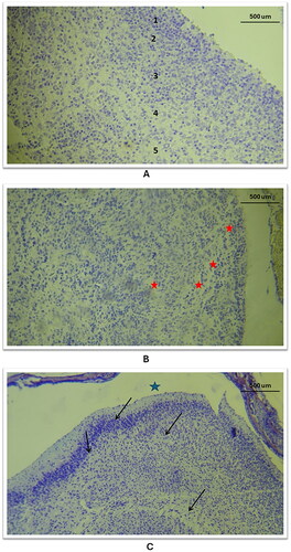 Figure 5. General histological changes of the cerebral cortex in the three study groups as compared to the control group (using Cresyl Violet stain). A: in the control group, a histological section of the cerebral cortex displayed the penta-laminar pattern of cerebral cortex layers (10X magnification), B: in study group A, a section revealed a defect in the laminar structure and the presence of spaces between layers, indicated by red stars (10X magnification); C: Study group B exhibited a defect in the layering pattern, as shown by black arrows, and atrophic changes characterized by an enlarged subarachnoid space, marked with a star shape (10X magnification).