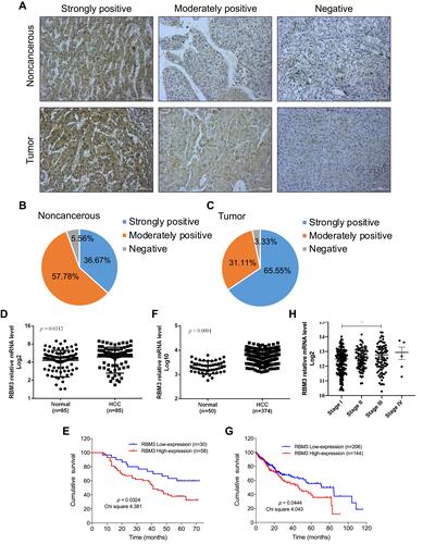 Figure 1 High expression of RBM3 is correlated with poor prognosis and shorter overall survival. (A) Representative images of RBM3 expression in tumor tissues and adjacent noncancerous tissues by immunohistochemical staining (magnification × 200). (B and C) Pie chart of IHC results of RBM3 expression in noncancerous and tumor tissues of 90 HCC patients. (D) Statistics of immunohistochemical staining for relative RBM3 expression in HCC tissues (n=85) and corresponding adjacent healthy tissues (n=85). Five HCC tissues and five healthy tissues showed a score of 0, so their log2 results are not exhibited. (E) Kaplan–Meier curves of cumulative survival plots for 88 HCC patients (two patients were lost to follow-up), including 58 patients with high RBM3 expression and 30 patients with low RBM3 expression. (F) Relative RBM3 expression in normal participants (n=50) and HCC patients (n=374) in the TCGA database. (G) Kaplan–Meier survival curves of cumulative survival plots for HCC patients from the TCGA database. The 350 HCC patients who participated in it included 144 patients with high RBM3 expression and 206 patients with low RBM3 expression. (H) Correlation between RBM3 expression and tumor progression from the TCGA database (stage I, n=173; stage II, n=87; stage III, n=85; stage IV, n=5). The log-rank (Mantel-Cox) test was used to compare differences between two groups. Error bar: mean ± SEM. *P < 0.05.