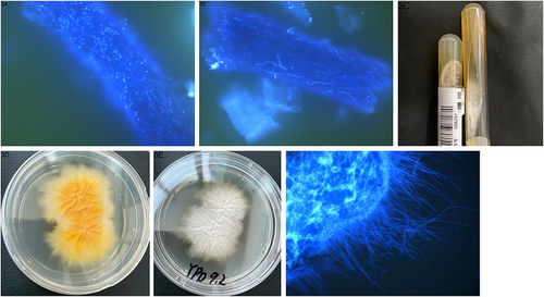 Figure 3 Images of diseased hair and fungal culture. Obvious spores (A) and hyphae (B) in the affected hair. The same mycelium as in the previous hair (C). Pathogenic fungi inoculated in Salmonella agar (D) and on YPD medium (E and F) give rise to woolly colonies.