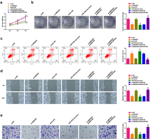 Figure 2. Silence of circ-UBE2D2 restrains the proliferation, migration and invasion of NSCLC cells.