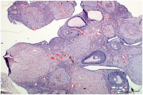 Figure 3. Increase in number of granule cell layers, presence of oocytes in follicles in resveratrol-treated rats with PCOS. H&E staining, ×500 mcm.