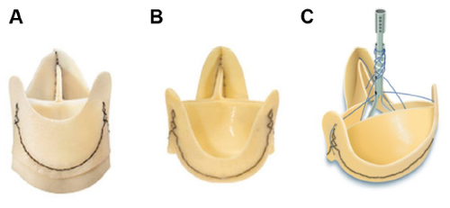 Figure 1 Pericarbon Freedom (A), Freedom SOLO (B), and SOLO Smart (C).