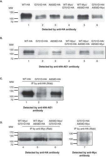 Figure 4.  Western blot analysis of total cell extracts of HA557- or Myc557-kAE1 WT, G701D, and A858D (A), and co-immunoprecipitation studies (B and C). MDCK cells were infected or co-infected for 12 days and lysed by 1% C12E8 buffer. The cell extracts were loaded onto 8% SDS-PAGE and transferred to nitrocellulose membrane. For co-immunoprecipitation, the cell extract was incubated with mouse anti-HA or rabbit anti-Myc antibodies followed by Protein G-Sepharose. The bound proteins were eluted with 2× Laemmli buffer and detected by Western blot. (A) The total expressed kAE1 protein was detected by mouse anti-HA followed by anti-mouse IgG-HRP antibodies. (B) The total expressed kAE1 protein was detected by rabbit anti-kNt-AE1 antibody. (C) HA557-kAE1 WT (lane 1), G701D (lane 2) and A858D (lane 3) were co-immunoprecipitated (Co-IP) by mouse anti-HA antibody and detected by rabbit anti-kNt-AE1 antibody followed anti-rabbit IgG-HRP conjugated antibody. (D) Co-IP of Myc557-kAE1 WT with kAE1 G701D-HA (lane 4), Myc557-kAE1 WT with kAE1 A858D-HA (lane 5), kAE1 A858D-Myc with kAE1 G701D-HA (lane 6), kAE1 G701D-HA with kAE1 A858D-Myc (lane 7). The samples of lanes 4–6 were co-immunoprecipitated by rabbit anti-Myc, detected by mouse anti-HA and followed by anti mouse IgG-HRP antibody. The sample of lane 7 was co-immunoprecipitated by mouse anti-HA, detected by rabbit anti-myc, and followed by anti rabbit IgG-HRP antibody.