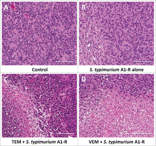 Figure 5. Histological analysis. Hematoxylin and eosin (H&E) stained slides from tumor tissue of each treatment group. A. Untreated control. B. S. typhimurium A1-R alone. C. S. typhimurium A1-R and TEM. D. S. typhimurium A1-R and VEM. Scale bars: 100 μm.