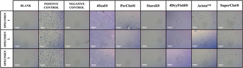 Figure 5 Cell culture images of cytotoxic potential assessment.