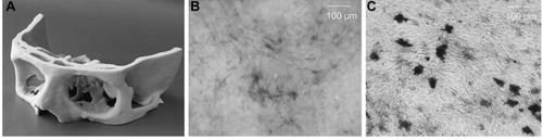 Figure 3 (A) 3D printed cranial segment; (B) MC3T3-E1 cells producing alkaline phosphatase (AP) after 21 days; and (C) MC3T3-E1 cells cultured on tricalcium phosphate/tetracalcium phosphate (TCP/TTCP) scaffolds after 21 days. Reprinted by permission from RightLink: Springer, J Eur Soc Biomater. Khalyfa A et al. Copyright, 2007.Citation77