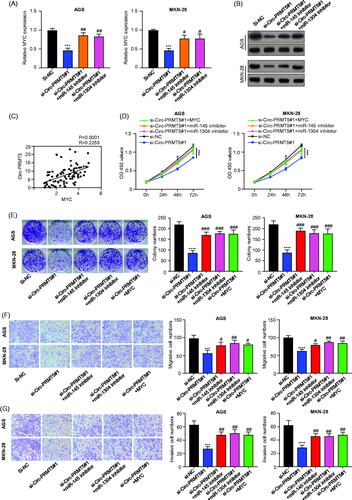 Figure 5. Circ-PRMT5 promoted GC progression by regulation of miR-145/1304/MYC axis. (A) The expression levels of MYC mRNA in AGS and MKN-28 cells with the infection of si-NC, si-circPRMT5#1, si-circPRMT5#1 + miR-145 inhibitor or si-circ-PRMT5#1 + miR-1304 inhibitor detected by qRT-PCR; (B) the expression levels of MYC protein in AGS and MKN-28 cells with the infection of si-NC, si-circ-PRMT5#1, si-circ-PRMT5#1 + miR-145 inhibitor or si-circ-PRMT5#1 + miR-1304 inhibitor detected by Western-Blotting; (C) Pearson correlation analysis of the association between circ-PRMT5 with MYC in GC tissues from 90 patients (same samples as in Figure 1(A)); (D) cell viability in AGS and MKN-28 cells with the infection of si-NC, si-circ-PRMT5#1, si-circ-PRMT5#1 + miR-145 inhibitor, si-circ-PRMT5#1 + miR-1304 inhibitor or si-circ-PRMT5#1 + MYC, at different time points, detected by CCK-8 assay; (E) Clone formation assay in AGS and MKN-28 cells with the infection of si-NC, si-circ-PRMT5#1, si-circ-PRMT5#1 + miR-145 inhibitor, si-circ-PRMT5#1 + miR-1304 inhibitor or si-circ-PRMT5#1 + MYC; (F) cell migration ability in AGS and MKN-28 cells with the infection of si-NC, si-circ-PRMT5#1, si-circ-PRMT5#1 + miR-145 inhibitor, si-circ-PRMT5#1 + miR-1304 inhibitor or si-circ-PRMT5#1 + MYC detected by Transwell assay; (G) cell invasion ability in AGS and MKN-28 cells with the infection of si-NC, si-circ-PRMT5#1, si-circ-PRMT5#1 + miR-145 inhibitor, si-circ-PRMT5#1 + miR-1304 inhibitor or si-circ-PRMT5#1 + MYC detected by Transwell with matrigel.