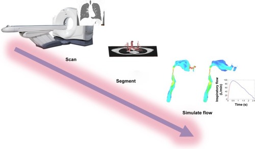 Figure 1 Overview of the FRI concept. Patients are first scanned. Then, the CT images are segmented, and the rendering of the airways is calculated. Then, a 3-dimensional model of the lung is developed. Finally, flow is simulated in this model using CFD techniques.Citation18