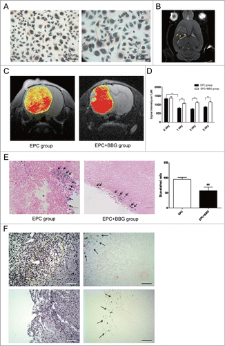 Figure 4. P2X7 receptors suppression inhibited the homing of USPIO-labeled EPCs to gliomas. (A) Representative imaging of in vitro Prussian blue staining revealing the morphology of USPIO-labeled EPCs. Scale bar: 50 μm (left), 25 μm (right). (B) Coronal T2-weighted imaging (T2WI) showing the USPIO-labeled EPCs (yellow arrow). (C) Representative T2 maps of glioma-bearing rats in EPC group and EPC + BBG group. Hypointensity accumulated in the region of USPIO-labeled EPCs. Red and yellow represent relative higher- and lower-value, respectively. (D) Changes of signal intensity on T2WI in EPC group and EPC + BBG group were analyzed. Data are mean ± SD from 6 independent experiments. **, P < 0.01. (E) Representative Prussian blue staining revealed the accumulation of USPIO-labeled EPCs at the periphery of gliomas (black arrows; left). The blue-stained cells were quantified (right).##P < 0.01 vs. Control. (F) The relationship between host macrophages and iron-positive cells. Multiple localized host macrophages (F4/80-positive cells, dotted ring) were observed (left up). However, the area of macrophage accumulation did not correspond to the site of incorporated iron-positive cells (arrows). No iron-positive cells are seen at the site of macrophage migration (right up), and no host macrophages (left down) are seen at the site of iron-positive cells (right down; arrows). Scale bar: 100 μm.