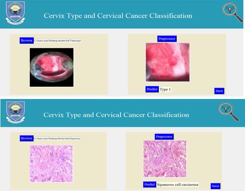 Figure 12 User interface for the proposed cervix type and cervical cancer classification system.