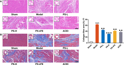 Figure 4 PS alleviated myocardial injury of AMI rats. (A) H&E staining of myocardial tissues, scale bar = 100 μm. (B) Masson staining of myocardial tissues, scale bar = 100 μm. (C) The percentage of collagen fiber area. Data were expressed as the mean ± SEM, n=3. ***P < 0.001, vs sham group; ▲▲P < 0.01, ▲▲▲P < 0.001, vs model group.