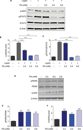 Figure 2 PA provokes hypothalamic leptin resistance and ER stress.