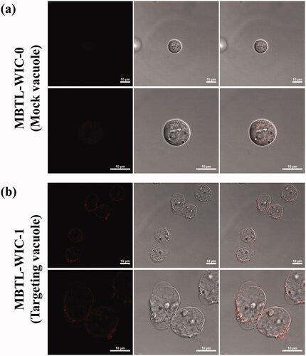 Figure 7. In vitro drug delivery to HL-60 was confirmed by confocal laser scanning microscopy. (a) is Mock and (b) is recombinant vacuoles (Scare bar, 10 µm).