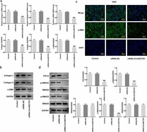 Figure 3. circHECTD1 knockdown inhibits the fibrosis and the expression of TGF-β/SMAD. (a) Collagen I, collagen II, and α-SMA mRNA expression in the three groups detected by RT-qPCR, and (b) western blot. (c) α-SMA expression detected by immunofluorescence. (d) TGF-β, p-SMAD2, p-SMAD3, SMAD2, SMAD3 expression detected by western blot. ***P < 0.001 versus siRNA-NC; n = 3.