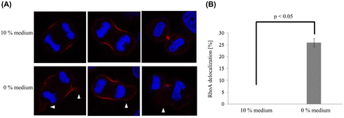 Figure 2. RhoA localization in two different media. (A) In 10% medium, RhoA was present at the equatorial cell cortex in anaphase and accumulated at the cleavage furrow. In contrast, in 0% medium, RhoA lacked symmetry (arrowhead). (B) The frequency of RhoA delocalization in 0% medium was significantly higher than that in 10% medium. Each value is the mean ± SD of three independent experiments.