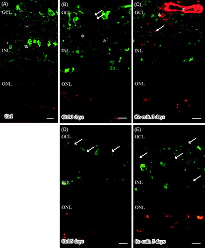 Figure 7. Immunofluorescent staining for calbindin (green) and the soluble terminal complement complex (sC5b-9, red) in retinal tissue and ARPE cells. Retinal nuclear layers (ONL, INL, and GCL) are indicated. Anti-calbindin antibody labels ganglion, horizontal, and amacrine cells in the retinal tissue (A–E). sC5b-9 (indicated by *) labels blood vessels in non-cultured control retinas (A), in retinas cultured for 3 days (B), and in retinas co-cultured for 3 days (C). After retinal culture or co-culture for 3 or 5 days, ganglion cells are sparsely positive for sC5b-9 (indicated by arrows in B–E). In co-cultured specimens, sC5b-9 seems to coincide with calbindin-positive cells in the INL. Scale bars, 20 μM.