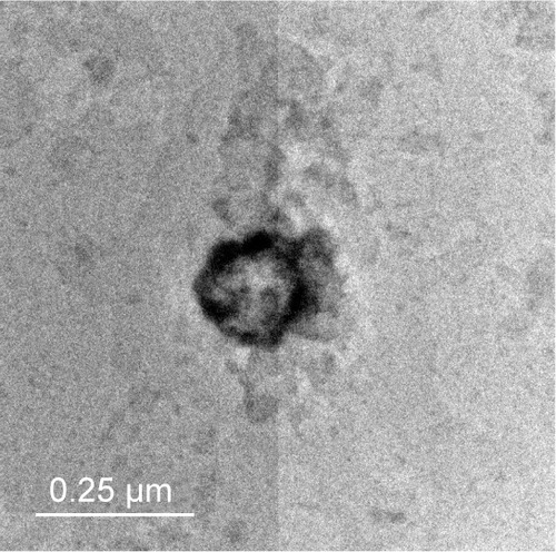 Figure 1 Transmission electron micrographs of the prepared transfersomes F4 when stained with uranyl acetate (10%) with scale 250 nm.