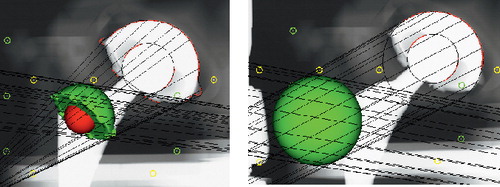 Figure 45.  Models are fitted to the ROI marked on the periphery of the cup in the stereo radiograph and the projection lines to the roentgen foci are visible. A) A scanned implant model. B) A computer generated sphere.