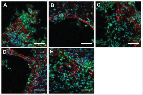Figure 4. Astrocyte and macrophage/microglia interactions with hybrid scaffolds implanted into the striatum 60 d post implantation. High magnification images (demarcated areas of corresponding images in Fig. 3) of astrocytes (GFAP, red) and macrophages/microglia (ED1, green) at the tissue-scaffold interface display cellular infiltration into the hybrid scaffold and utilization of the electrospun fiber network. Nuclei were labeled with DAPI (blue). The samples were as follows: (A) Blank hydrogel, (B) PLLA fibers – low density, (C) PLLA + fibronectin fibers – low density, (D) PLLA fibers – high density, and (E) PLLA + fibronectin – high density. The fibronectin fiber samples, (C and E), display a greater extent of cellular infiltration into the hybrid matrix as well as a more loosely defined glial boundary as compared to that displayed in B. Images were captured with a 40X objective lens. Z-stack ranges were optimized for each fluorescence channel and captured independently. Scale bar represents 50 μm.