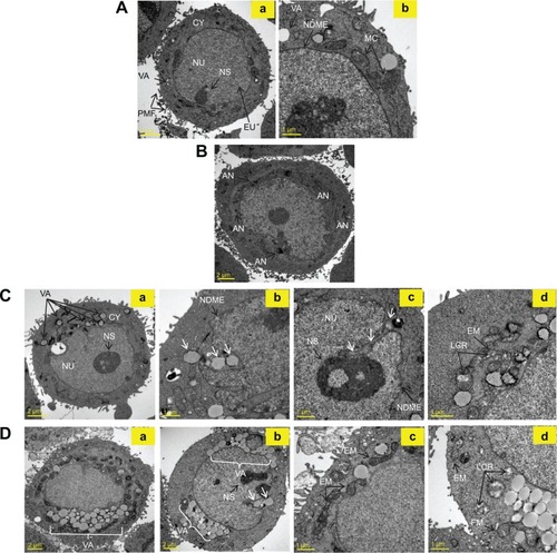 Figure 9 TEM images of the cellular uptake of HT-29 cells as affected by various treatments.Notes: (A) (a and b) Control representing the untreated HT-29 cell. (B) Treatment with 10 ppm of AN. (C) (a–d) Combo treatment containing 10 ppm of AN plus 12 μM of LP. (D) (a–d) Nanoemulsion treatment containing different levels of AN and LP including AN 0.04 ppm + LP 0.1 μM (Da and Dc) and AN 0.16 ppm + LP 0.4 μM (Db and Dd). (Cb, Cc, and Db) The white arrows indicate nuclear envelope folds engulfing the vacuoles containing the AN+LP combo or nanoemulsion containing AN+LP.Abbreviations: CY, cytoplasm; NU, nucleus; NS, nucleolus; VA, vacuoles; PMF, plasma membrane filaments; EU, euchromatin; NDME, nuclear double layer membrane; MC, mitochondria; AN, gold nanoparticle; LCR, loss of cristae seen as white portions inside the mitochondria; EM, abnormally elongated mitochondria; FM, formation of fused mitochondria; TEM, transmission electron microscopy; LP, lycopene.