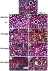 Figure 4 Representative photomicrographs of kidney tissues of mice treated with different doses of ZnO-NPs (50, 300 and 500 mg/kg) with and without NAC (100 mg/kg) pretreatment. (NK) normal kidney group showing no histopathological change, (A) ESC group showing normal histological structure of renal parenchyma, (B) ESC+NAC group showing the normal histological structure of renal parenchyma, (C) ESC+50 ZnO-NPs group showing vacuolation of renal tubular epithelium (black arrow) and presence of protein cast in Bowman’s space (red arrow), (D) ESC+50 ZnO-NPs+NAC group showing vacuolation of epithelial lining renal tubules and hyalinosis of glomerular tuft (E) ESC+300 ZnO-NPs group showing slight congestion of glomerular tufts glomerular tuft, (F) ESC+300ZnO-NPs+NAC group showing no histopathological changes, (G) ESC+500ZnO-NPs group showing focal interstitial mononuclear inflammatory cells infiltration, (H) ESC+500 ZnO-NPs+NAC group showing vacuolation of epithelial lining renal tubules (head arrow) and renal cast in the lumen of renal tubules (H and E × 400).