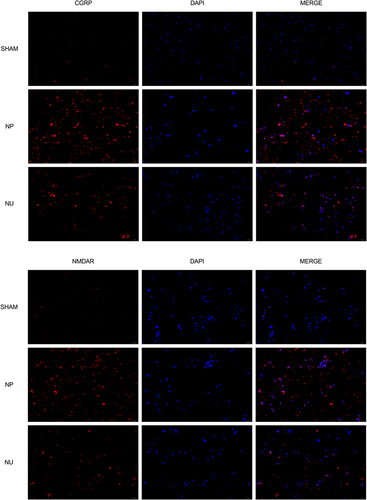 Figure 5 The expression of CGRP and NMDAR affected by KOR agonist in rats’ dorsal root ganglia detected by IF (scale bar = 20µm).