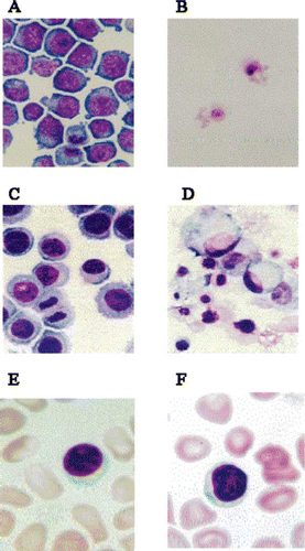 Figure 2 Suppressive effects of the Japanese apricot, Ume (prunus mume Siev. et Zucc) on the growth of cancer cells. HL-60 promyelocytic leukaemia cell lines and Kato-III stomach cancer cell lines were grown in culture in the presence and absence of the Ume extract at 2 μL/mL. A), growth of HL-60 cells in the presence of the vehicle; B), HL-60 cells grown in the presence of Ume extract, no viable cell was found in the test sample; C), growth of Kato-III cells in the absence of the Ume extract; D), Kato-III cells grown in the presence of Ume extract. No viable cell was found in this test sample. E), human blood cells incubated in the presence of vehicle for 24 hr; and, F) human blood cells incubated in the presence of 10 μL/mL Ume extract. There was no loss of viability or cell damage in E and F.