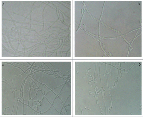 Figure 2. Light microscopy photomicrographs of in vitro Candida albicans filamentation. (A) Control group (PBS): intense formation of hyphae. (B) C. albicans + L. acidophilus cells group: presence of some hyphae. (C) Control group (MRS broth): intense formation of hyphae. (D) C. albicans + L. acidophilus culture filtrate group: note the presence of few hyphae. Original magnification: 400×.