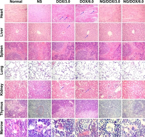 Figure 9 Histopathology analyses of visceral organ sections.Notes: Histopathology analyses of visceral organ sections, that is, heart, liver, spleen, lung, kidney, thymus, and marrow, from normal mice, or H22 hepatoma-xenografted BALB/c mice after treatment with NS as control, or free DOX·HCl or NG/DOX at a dosage of 3.0 mg or 6.0 mg DOX·HCl equivalent per kg body weight. The arrows in the heart, liver, and kidney sections indicate a certain myocardial damage and fracture, the blood oozing and nucleus shrinking of liver tissue, and nephrotoxicity judged from the glomerular mesangial cell proliferation, respectively. The virtual coil indicates the tumor metastasis in thymus. Magnification: 200×.Abbreviations: DOX, doxorubicin; DOX·HCl, doxorubicin hydrochloride; NG/DOX, DOX-loaded nanogel; NS, normal saline.