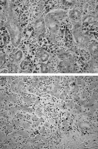 Figure 4.  4a: Numerous apoptotic cells in the renal tubules of an EG-intoxicated goose. Note that while apoptotic cell death occurs in all cells of a tubule, single or a few apoptotic cells are also present in a single tubule. In situ TUNEL staining, ×370. 4b: Some apoptotic cells located in the periportal region of liver of an EG-intoxicated goose, In situ TUNEL staining×370.