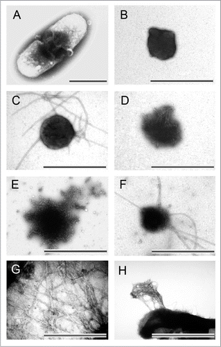 Figure 2 Morphology of bacterial inclusion bodies observed under electron microscope. (A) An E. coli cell containing inclusion body of ESAT-6, (B) Inclusion bodies of BMP2(13–74) after purification, (C) Inclusion body of BMP2(13–74) after incubation at 37°C for 12 hours, (D) Inclusion body of BMP2(13–74) after grown in host cells for 12 hours, (E) Inclusion body of BMP2(13–74) after disaggregated in 4 M of urea solution, (F) Inclusion body of ESAT-6 after incubation at room temperature for 14 days, (G) Inclusion body of Aβ42 after proteinase K proteolytic action, (H) Inclusion body of HET-s(218–289) after three hours expression. Scale bars indicate 1 µm. (Partial reproduction of Figs. 5, S7,Citation52 5,Citation53 and S4,Citation46).