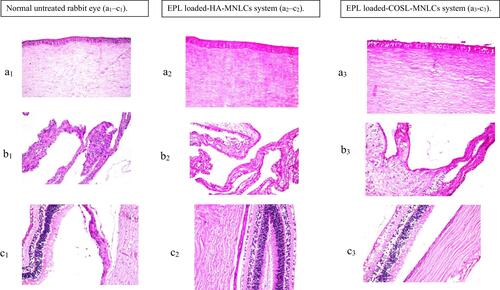 Figure 7 Histopathological stained sections (hematoxylin and eosin) of normal untreated rabbit eyes (a1–c1)and rabbit eyes treated with Epl loaded HA-MNLCs (a2–c2) and Epl loaded COSL-MNLCs (a3–c3), where “a” represents the outer layer of the cornea, “b” the irisand ciliary process, and “c” the retina, choroid, and sclera at magnification 40×.