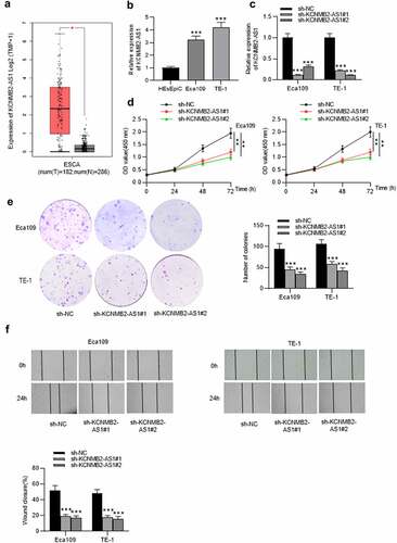 Figure 1. The effects of KCNMB2-AS1 knockdown on ESCA cell growth, motion, and stemness.