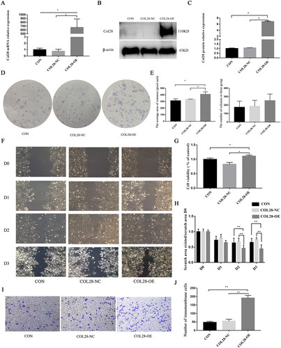 Figure 3. Overexpression of COL28 promotes HK-2 cell proliferation and migration. The mRNA (A) and protein (B-C) expression of COL28 in HK-2 cells. Effect of COL28 overexpression on the proliferation of HK-2 cells detected by the plate cloning method (D-E). *p < 0.05. Comparison of the cell viability in the CON, COL28-NC, and COL28-OE groups by CCK-8 (G). *p < 0.05. Cell migration ability in the three groups by the wound healing test (F&H) **p < 0.01. Cell migration ability in the three groups by the Transwell assay (I-J). **p < 0.01. All experiments were performed three times.