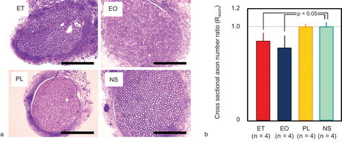Figure 8. Axon numbers in cross-sections of the femoral nerve. (a) Cross-section of the femoral nerve (toluidine blue staining). Scale bars represent 10 µm. (b) Ratio of the cross-sectional axon number on the treated side to that on the untreated side (Raxon). ET and EO significantly reduced the axon number compared with the NS control (p < 0.05). Error bars indicate standard deviation. ET = ethanol; EO = ethanolamine oleate; PL = polidocanol; NS = normal saline.