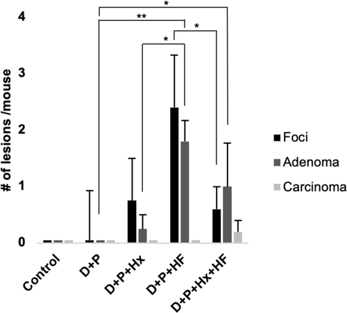 Figure 3 The average number of lesions per mouse was determined by histology. The bars depict the average number of foci of altered hepatocytes (foci, black bars), hepatocellular adenoma (adenoma, dark gray bars) and hepatocellular carcinoma (carcinoma, light gray bars) per mouse for control and each treatment group. Asterisks indicate a significant difference in the average number of adenomas between D+P and D+P+HF (**p <0.01) and D+P and D+P+Hx+HF (*p <0.05). N ≥ 3 mice per group.