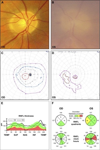 Figure 1 Patient 1.