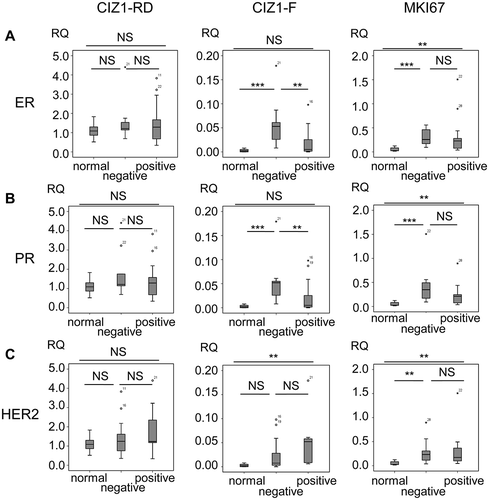Figure 6. CIZ1-F expression is increased in ER-negative tumors.Box-plots showing CIZ1 replication domain (CIZ1-RD; left), CIZ1-F (middle) and MKI67 (right) expression in (a) normal samples and estrogen receptor (ER)-positive and -negative tumors, (b) normal samples and progesterone receptor (PR)-positive and -negative tumors, and (c) normal samples and HER-2-positive and -negative tumors. RQ’s are expressed relative to mean CIZ1-RD-expression of normal samples. Significant differences between subgroups are indicated (Mann Whitney U-tests; NS, not significant). Primer and probe sequences are in Supplementary Table 2.