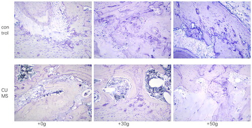 Figure 4. TRAP staining revealed increased staining of osteoclasts in the alveolar bone in the tooth movement area in the CUMS group.