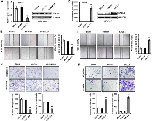 Figure 1 SALL4 knockdown inhibits, while overexpression promotes the migration and invasion of gastric cancer cells.Notes: (A) The efficiency of SALL4 knockdown was verified by using qRT-PCR and Western blot. (B) Cell scratch assay for the motility of MGC-803 cells with SALL4 gene knockdown. (C) Transwell migration and Matrigel invasion assays for the migration and invasion abilities of MGC-803 cells with SALL4 gene knockdown. (D) The efficiency of SALL4 overexpression was verified by using qRT-PCR and Western blot. (E) Cell scratch assay for the motility of SALL4-overexpressing HGC-27 cells. (F) Transwell migration and Matrigel invasion assays for the migration and invasion abilities of SALL4-overexpressing HGC-27 cells. **P<0.01.Abbreviation: qRT-PCR, quantitative real-time PCR.