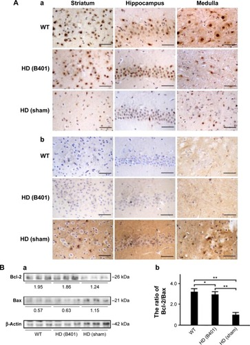 Figure 8 The ratio of anti-apoptosis-related Bcl-2/Bax in the brain tissue of the R6/2 (HD) mice was increased under oral B401 treatment.Notes: IHC staining shows that (Aa) the expressions of Bcl-2 were in the striatum, hippocampus, and medulla of the 10-week-old R6/2 mice given the oral B401 treatment were obviously greater than those given the sham treatment, but (Ab) the expressions of Bax were obviously weaker than those given the sham treatment. Western blotting analysis shows the following: (Ba) expression levels of Bcl-2 and Bax in whole brain tissue of the 10-week-old R6/2 mice given both oral B401 and sham treatments, and their WT and (Bb) the quantified brain ratio of Bcl-2/Bax in the 10-week-old R6/2 mice was significantly lower than their WT and significantly higher under oral B401 treatment. The number of R6/2 mice under oral B401 and sham treatments and their WT was six for each group. Values are mean ± SEM (*P<0.05, **P<0.01, two-way ANOVA followed by a Student–Newman–Keuls multiple comparison posttest).Abbreviations: Bax, Bcl-2-associated X protein; Bcl-2, B-cell lymphoma 2; HD, Huntington’s disease; IHC, immunohistochemistry; WT, wild-type littermate; ANOVA, analysis of variance; SEM, standard error of the mean.