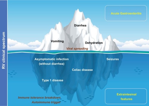 Figure 1 The “iceberg” model of RV infection proposal: AGE and diarrhea are just the most obvious and frequent clinical picture of the pathology by RV.Notes: Systemic viral spreading occurs and might produce several other extraintestinal manifestations such as seizures in the CNS (Table 1). Moreover, RV infection may be a trigger for the development of autoimmune pathology in individuals with a specific genetic background through a proposed mechanism of immune tolerance breakdown at early ages.Abbreviations: AGE, acute gastroenteritis; CNS, central nervous system; RV, rotavirus.