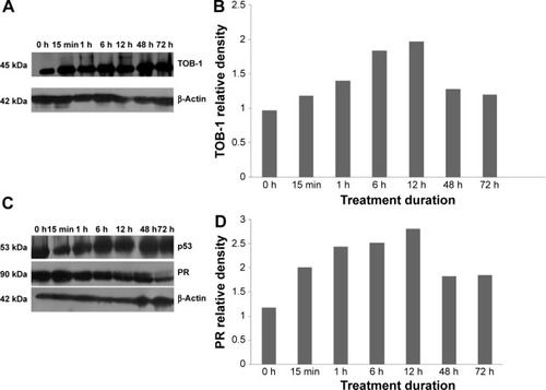 Figure 2 Progesterone activates TOB-1, PR, and p53 in breast cancer cells.