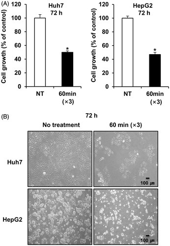 Figure 2. mEHT suppresses proliferation in HCC cells. (A) Measurement of cell viability in Huh7 and HepG2 cells 72 h after the third mEHT treatment. Data represent three independent experiments. NT, no treatment; *P < 0.05 by Wilcoxon rank sum test. (B) Representative light microscopy images of Huh7 and HepG2 cells 72 h after three mEHT treatments. Scale bar, 100 μm.