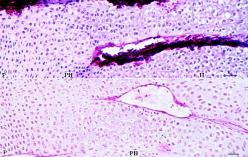 Figure 1.  Histological characteristics of the different zones of tibia growth plate 4 days after feeding the thiram-containing diet. (Bar=200 µm.) P, proliferative zone; PH, prehypertrophic zone; H, hypertrophic zone. The growth plate of the thiram diet-fed chicken was thickened significantly.