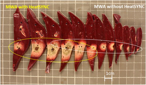 Figure 1. Example ablation zones in porcine liver in vivo following 60 W, 10 min MWA with a clinical ablation system (Perseon MicrothermX) when ablation was performed with (left) vs. without (right) ∼2 ml HeatSYNC gel. The illustrated tissue sections are taken approximately perpendicular to the axis of the MWA applicator and were stained with TTC viability stain. The grid markings in the figure represent a distance of 1 cm.