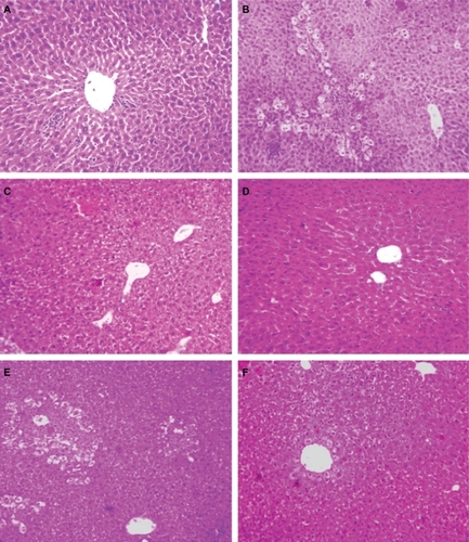 Figure 4 Liver histology (10×) in mice. Normal control (A), APAP only treated (B), APAP on silymarin pretreatment (C), APAP on silymarin nanoparticle pretreatment (D), silymarin posttreatment and APAP (E), silymarin nanoparticle posttreatment and APAP (F).Abbreviation: APAP, paracetamol.