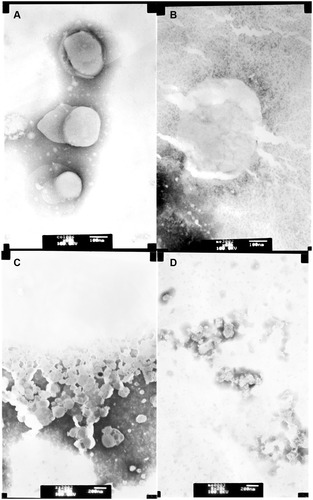 Figure 6 Transmission electron microscopy images of LUVs composed by different phospholipids. Upper panel: LUVs composed of neutrally charged PC and cholesterol (9:1, wt:wt), (A) neutrally charged LUVs treated with PBS buffer; (B) neutrally charged LUVs incubated with 50 μg/mL Melectin; lower panel: LUVs composed of negatively charged DPPG/DPPE (7:3, wt:wt). (C) Negatively charged LUVs treated with PBS buffer; (D) negatively charged LUVs incubated with 50 μg/mL Melectin.